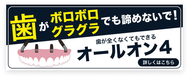 歯がボロボログラグラでも諦めないで！歯が全くなくてもできるオールオン4
